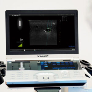 VINNO 6 Laptop Ultrasound Scanner