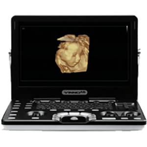 VINNO A6 Laptop Ultrasound Scanner