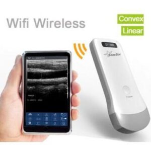 Wireless Ultrasound Probe